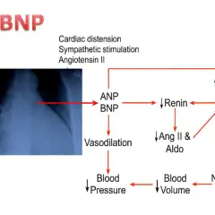 Schema che illustra il ruolo del peptide natriuretico tipo b (BNP) nella regolazione della pressione sanguigna e del volume ematico, con un rx torace a sinistra.