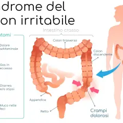 Illustrazione della sindrome del colon irritabile con sintomi: dolore addominale, gas, diarrea/stipsi, muco. Una dieta depurativa colon irritabile può aiutare.