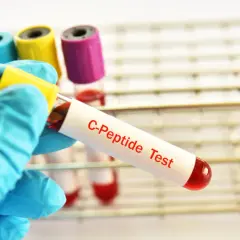 Tubo da test con etichetta "C-Peptide Test" e campione di sangue rosso, pronto per analisi. Un valore di peptide c alto può indicare problemi di salute.