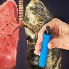 Polmoni sani a sinistra, malati a destra. Una mano tiene una sigaretta elettronica, dimostrando che la sigaretta elettronica fa male.