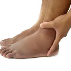 Piedi gonfi, un segno che potrebbe indicare problemi al fegato. La mano preme sulla caviglia per valutare il gonfiore.