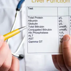 Medico indica esami del fegato, evidenziando i valori di bilirubina diretta e indiretta.