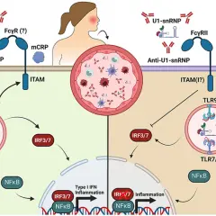 Schema che illustra come anticorpi anti-U1-snRNP attivano TLR9, portando a infiammazione, a differenza di una proteina c reattiva bassa.