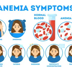 Sintomi di anemia: mal di testa, insonnia, affanno, stanchezza, vertigini, difficoltà di concentrazione e pallore. Il ferro basso può causare questi problemi.