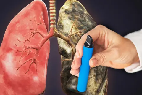 Polmoni sani a sinistra, malati a destra. Una mano tiene una sigaretta elettronica, dimostrando che la sigaretta elettronica fa male.