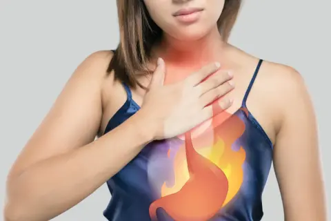 Donna con mano sul petto, evidenziato un bruciore allo stomaco e alla gola.
