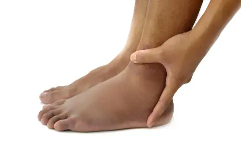 Piedi gonfi, un segno che potrebbe indicare problemi al fegato. La mano preme sulla caviglia per valutare il gonfiore.