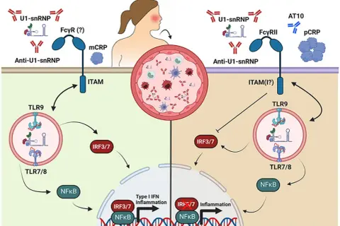Schema che illustra come anticorpi anti-U1-snRNP attivano TLR9, portando a infiammazione, a differenza di una proteina c reattiva bassa.