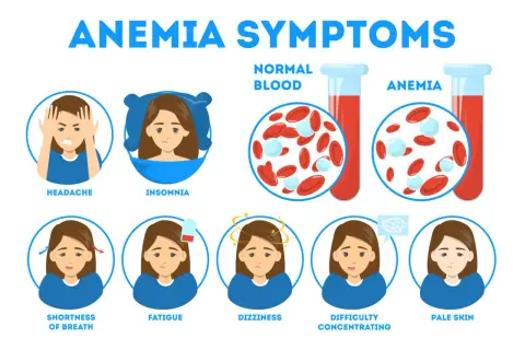 Sintomi di anemia: mal di testa, insonnia, affanno, stanchezza, vertigini, difficoltà di concentrazione e pallore. Il ferro basso può causare questi problemi.