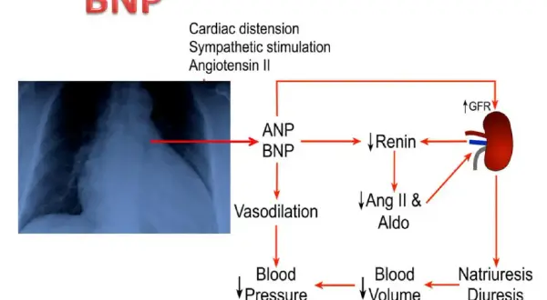 Schema che illustra il ruolo del peptide natriuretico tipo b (BNP) nella regolazione della pressione sanguigna e del volume ematico, con un rx torace a sinistra.