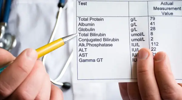 Medico indica esami del fegato, evidenziando i valori di bilirubina diretta e indiretta.