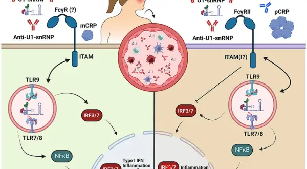 Schema che illustra come anticorpi anti-U1-snRNP attivano TLR9, portando a infiammazione, a differenza di una proteina c reattiva bassa.