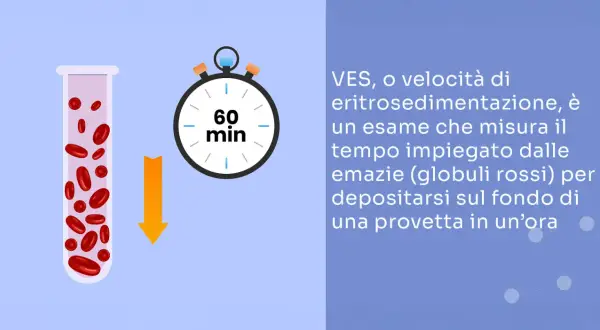 VES, esame sangue: globuli rossi in provetta e cronometro segnano 60 min, indicando il tempo di sedimentazione.