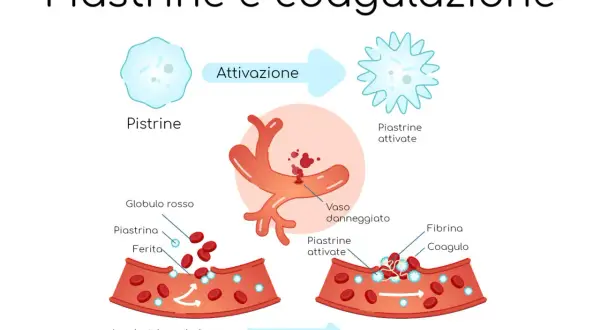 Illustrazione del processo di coagulazione del sangue: le piastrine, quando i piastrine valori normali sono compromessi, si attivano e formano un coagulo.