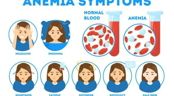 Sintomi di anemia: mal di testa, insonnia, affanno, stanchezza, vertigini, difficoltà di concentrazione e pallore. Il ferro basso può causare questi problemi.