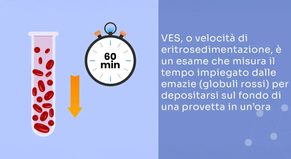 VES, esame sangue: globuli rossi in provetta e cronometro segnano 60 min, indicando il tempo di sedimentazione.