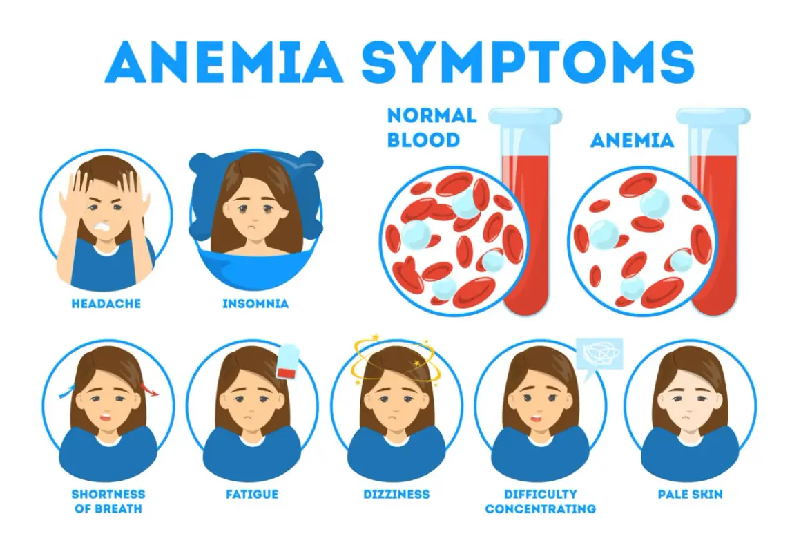Sintomi di anemia: mal di testa, insonnia, affanno, stanchezza, vertigini, difficoltà di concentrazione e pallore. Il ferro basso può causare questi problemi.