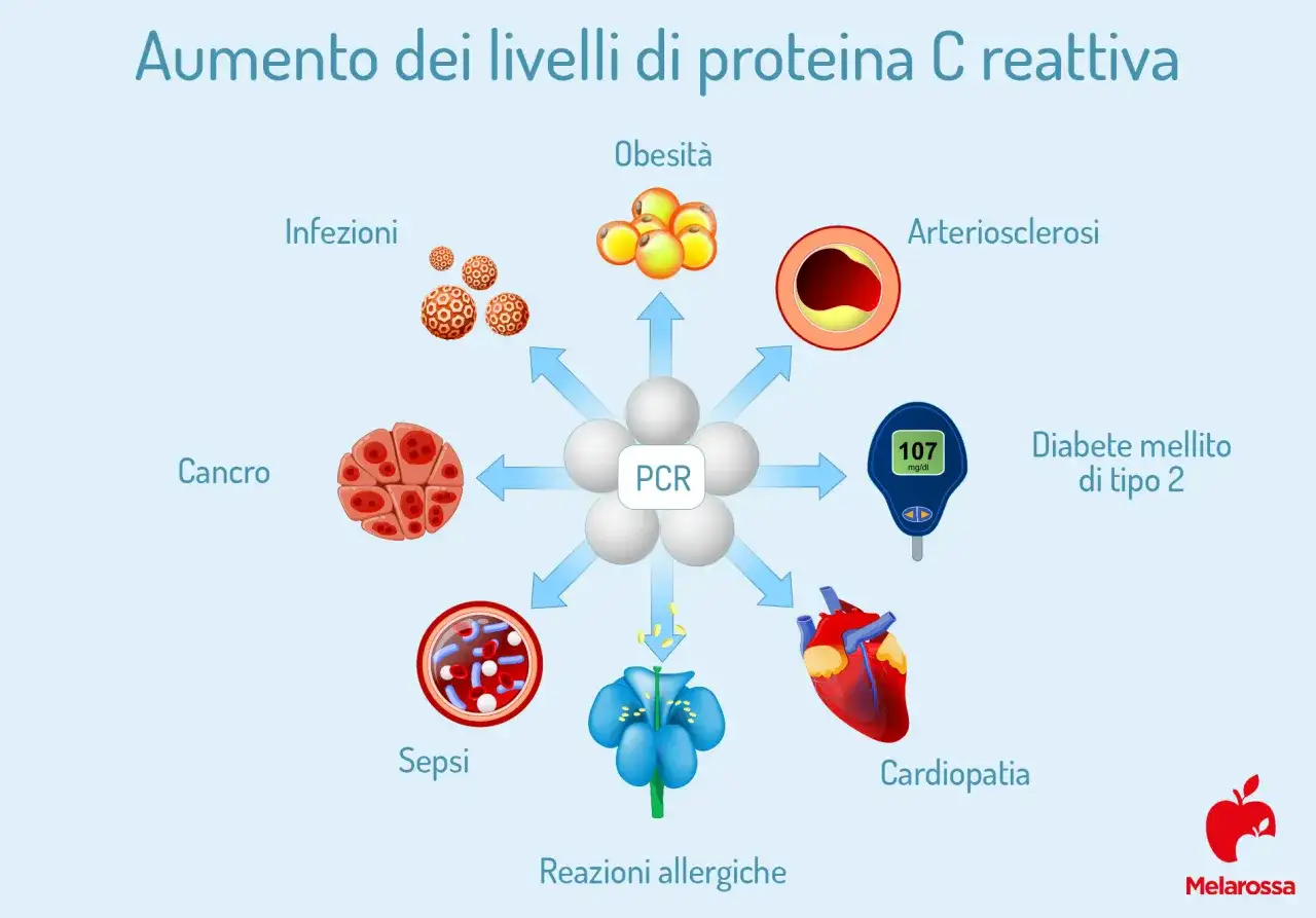 Proteina C reattiva alta - cosa significa e quando preoccuparsi