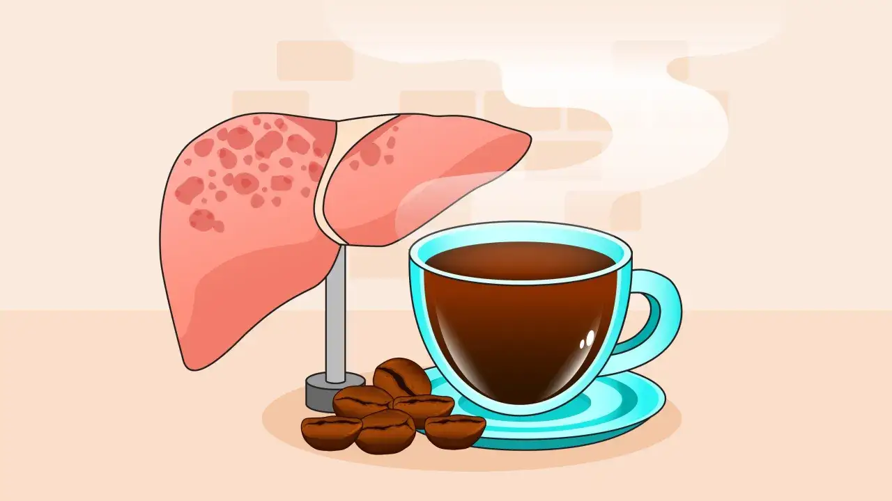 Fegato malato con macchie rosse accanto a una tazza di caff&egrave; fumante e chicchi. Il caff&egrave; fa male al fegato, suggerisce l'immagine.