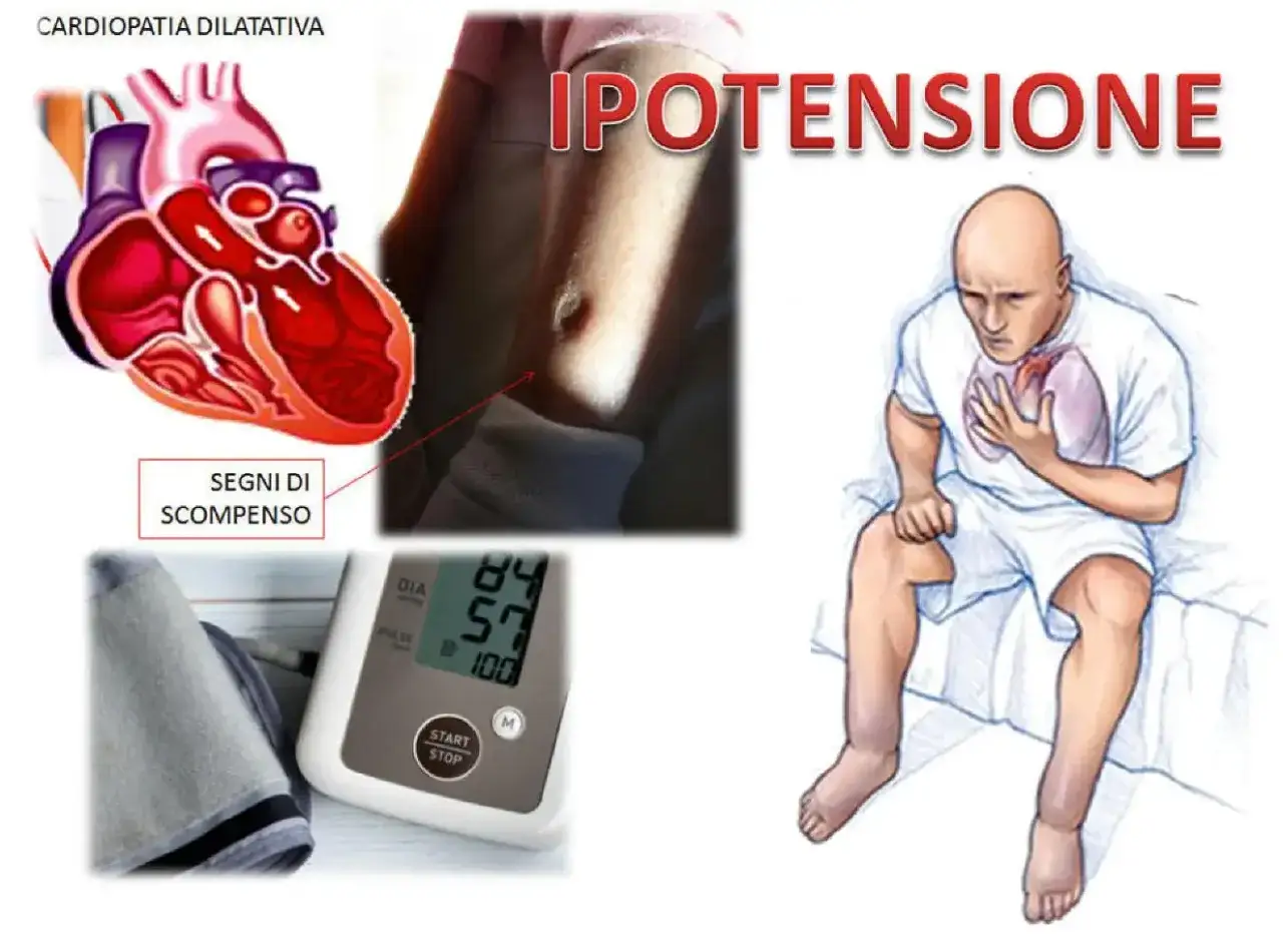Immagine mostra un cuore, un braccio con un segno, un misuratore di pressione e un uomo con dolore al petto. Attenzione se la pastiglia abbassa troppo la pressione.