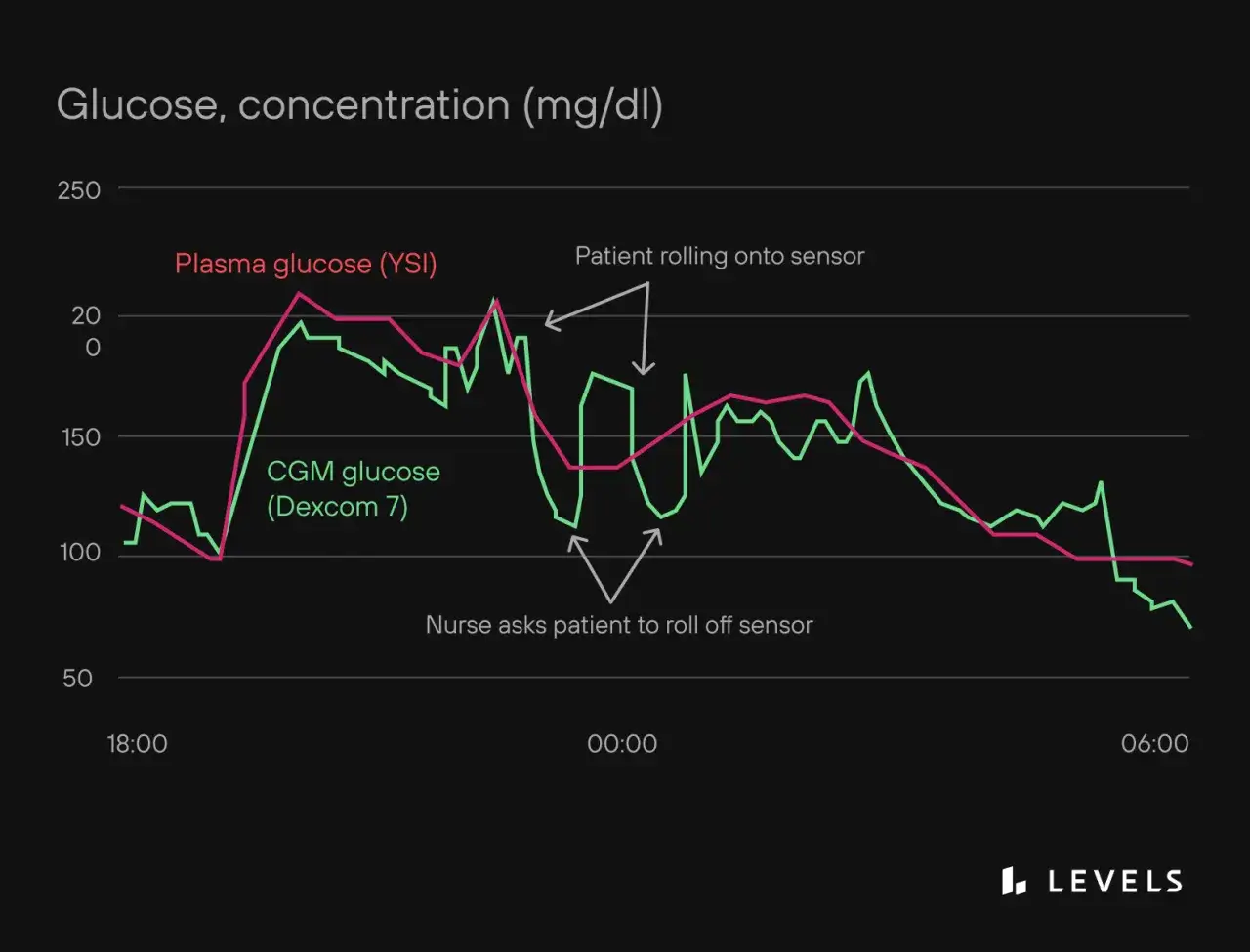 Grafico mostra glicemia alta di notte, con picchi e cali. Il paziente si gira sul sensore, poi la infermiera chiede di spostarlo.