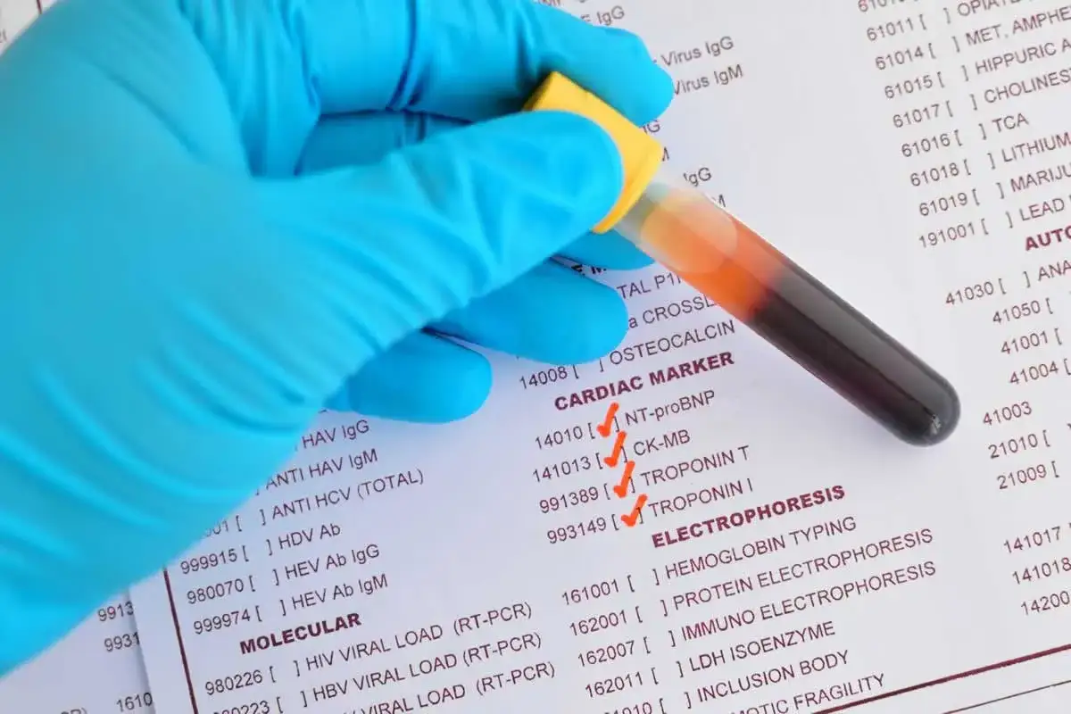 Mano con guanto blu tiene provetta con sangue. Lista di esami medici, tra cui 
