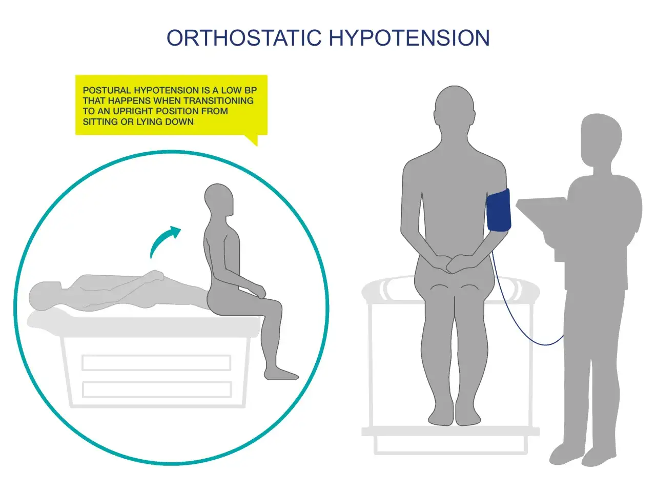 Illustrazione di ipotensione ortostatica, con un diagramma che mostra il passaggio da sdraiato a seduto, e un medico che misura la pressione. Cause di pressione minima bassa.