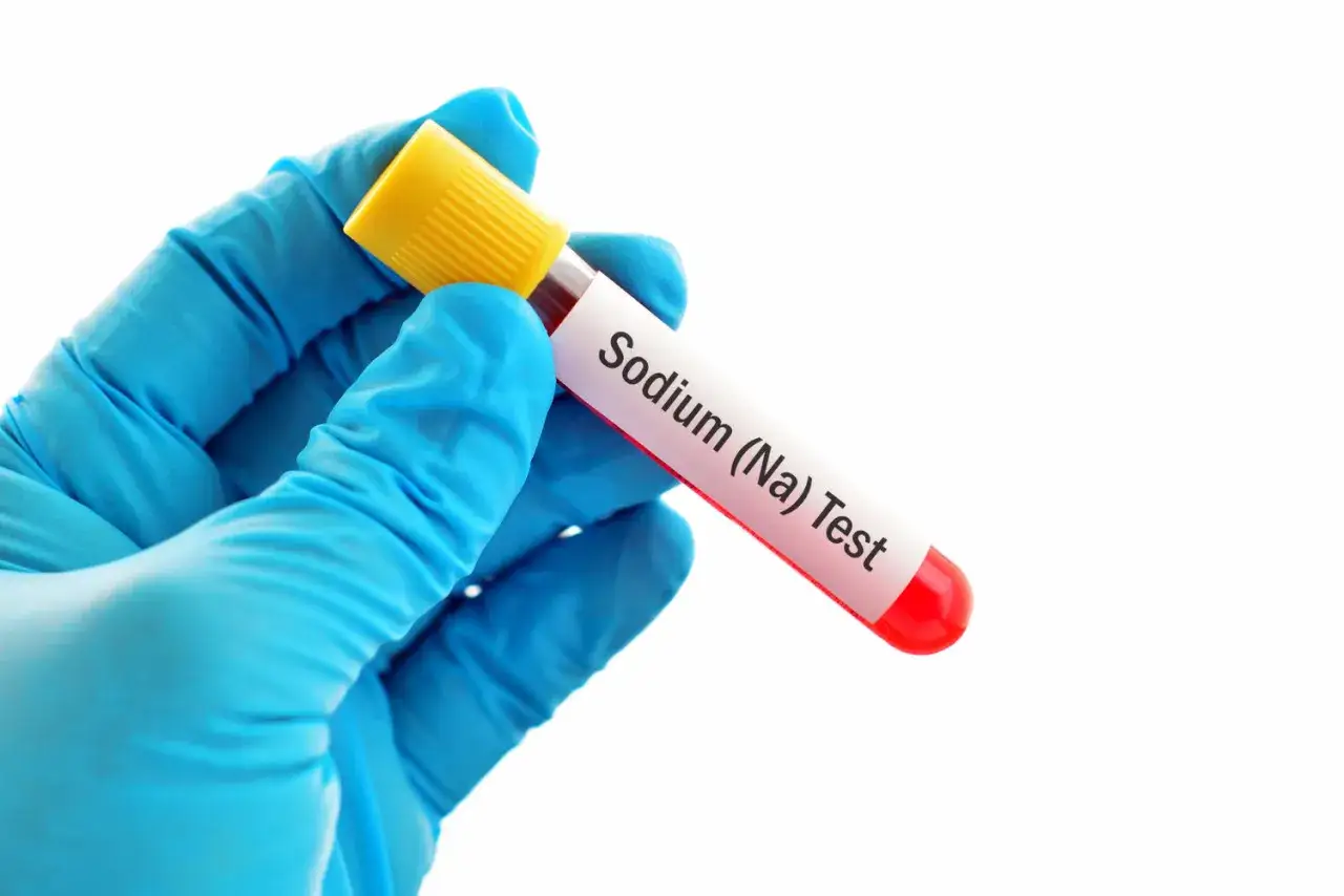 Mano con guanto blu tiene provetta con campione di sangue per test sodio nel sangue.