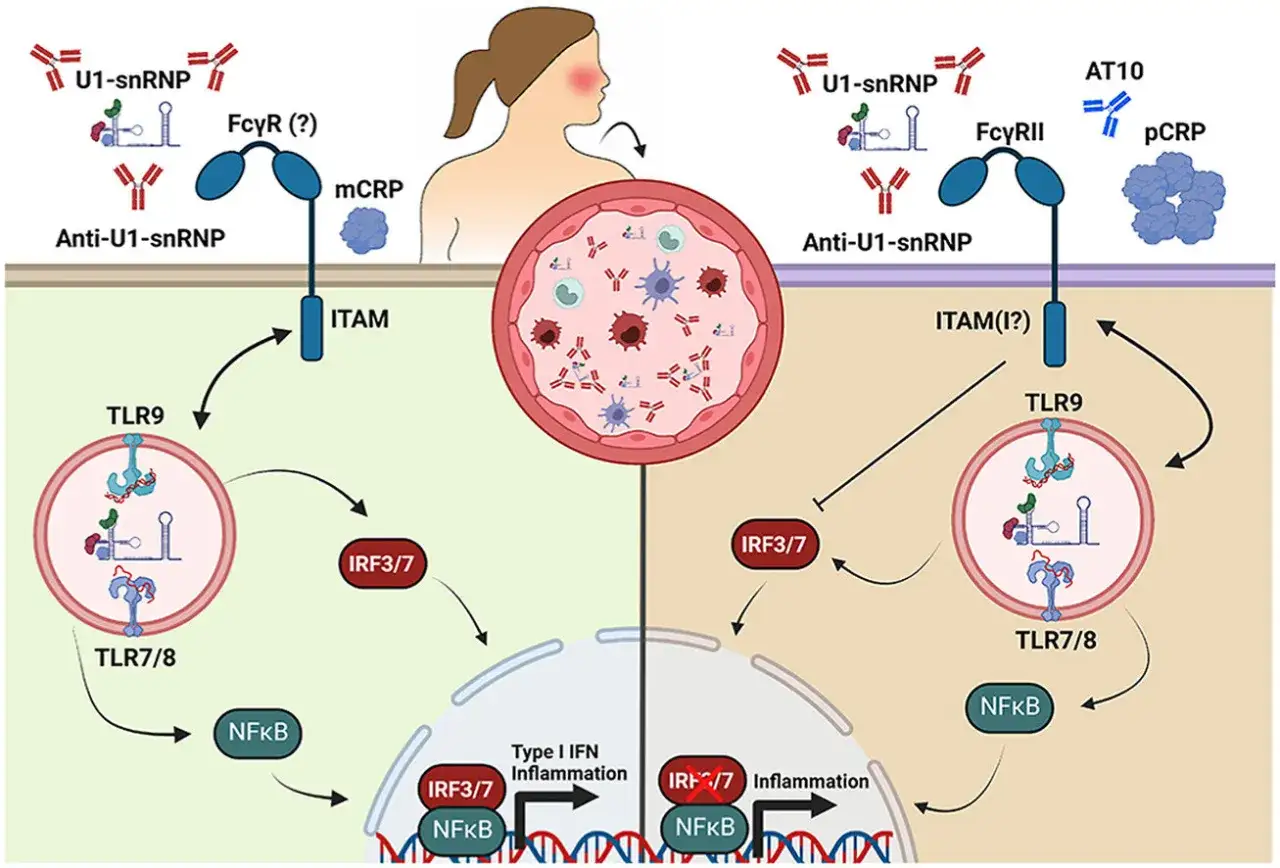 Schema che illustra come anticorpi anti-U1-snRNP attivano TLR, portando a infiammazione e potenziale proteina c reattiva alta.