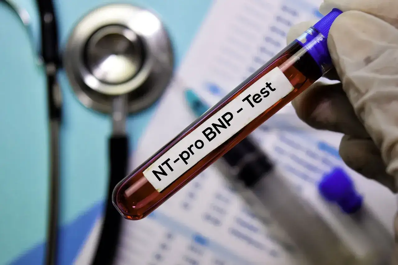 Provette con campione di sangue per test NT-proBNP, indicativo del peptide natriuretico tipo b, con stetoscopio e siringa sullo sfondo.