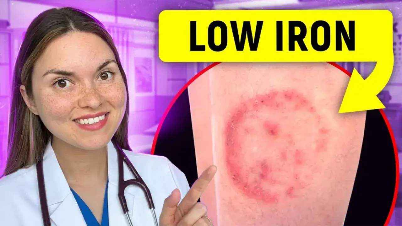 Medico indica eruzione cutanea, possibile sintomo di carenza di ferro nel viso e corpo.