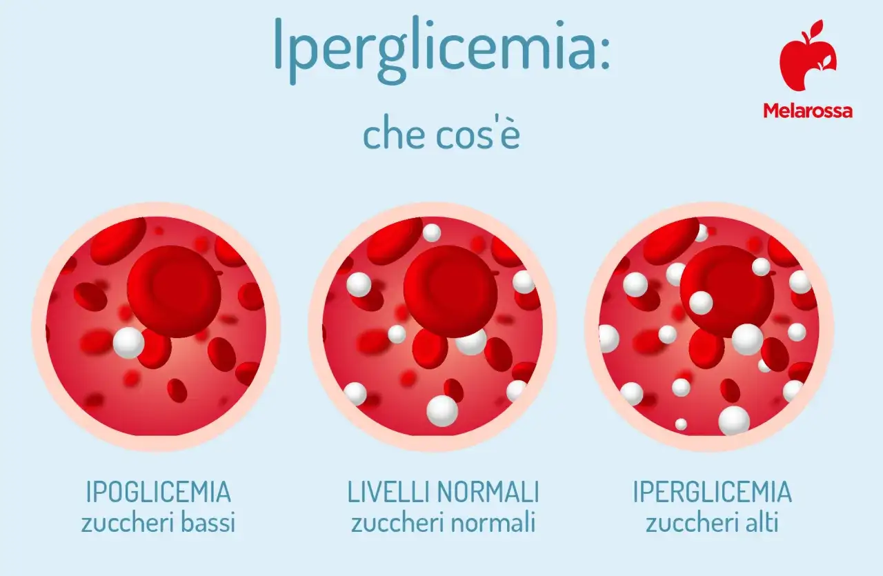 Iperglicemia: cosa fare se la glicemia è 240? L'immagine mostra globuli rossi e zuccheri in ipo-, normali e iperglicemia.