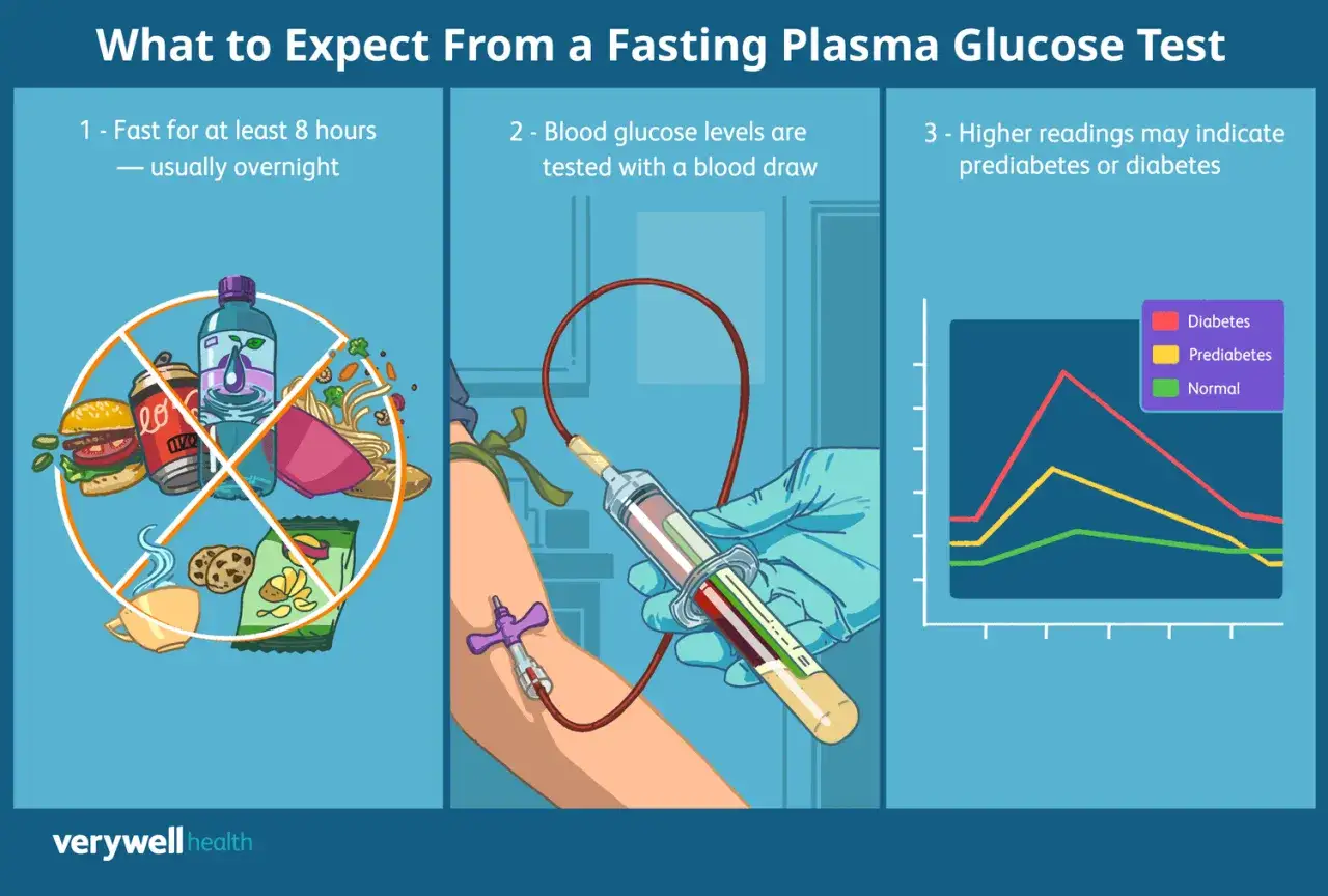 Illustrazione che mostra il digiuno, il prelievo di sangue e un grafico con la curva da carico di glucosio, indicando i livelli di diabete, prediabete e normali.