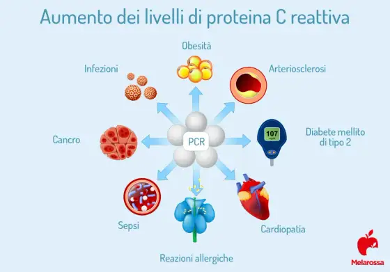Proteina C reattiva alta - cosa significa e quando preoccuparsi